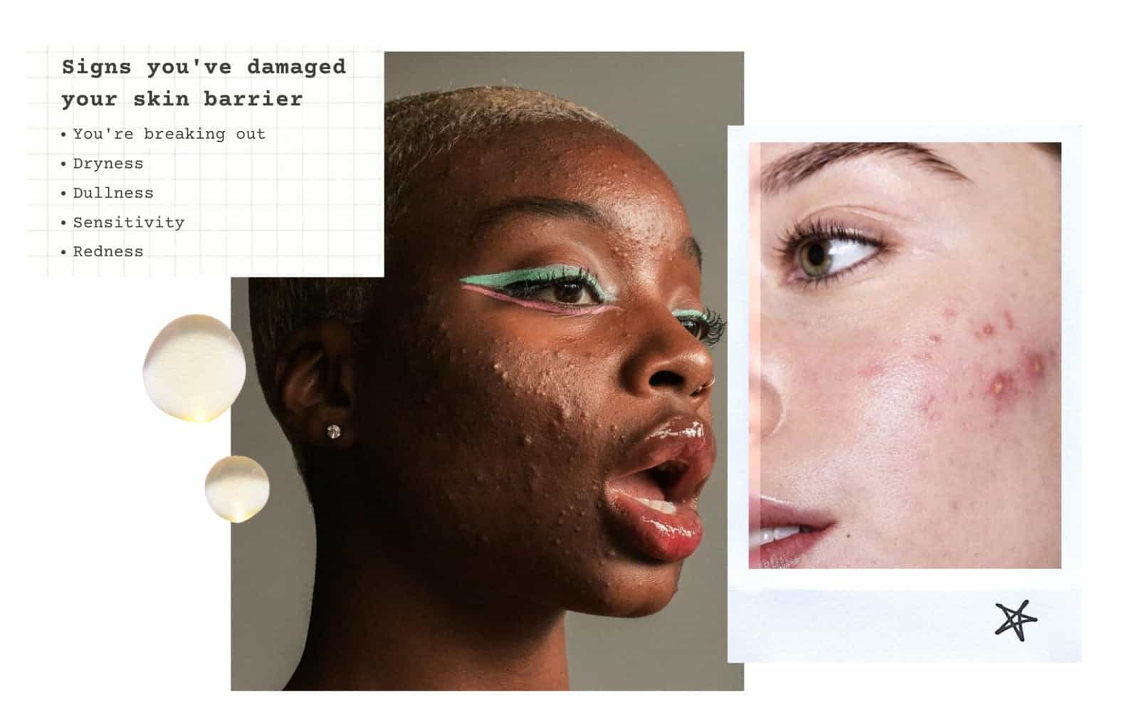 What's my skin barrier, and how does it get damaged? - ISOBEL PERL